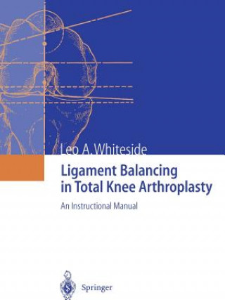 Carte Ligament Balancing in Total Knee Arthroplasty Leo A. Whiteside