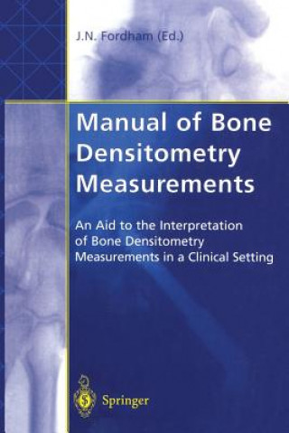 Buch Manual of Bone Densitometry Measurements John N. Fordham