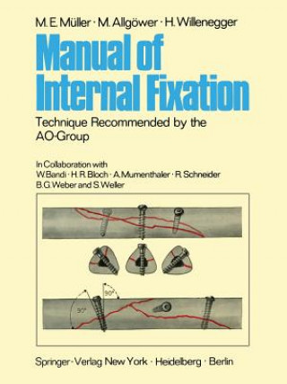 Книга Manual of Internal Fixation H. Willenegger