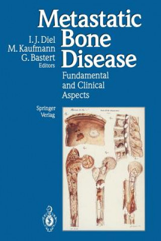 Книга Metastatic Bone Disease 