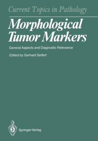 Książka Morphological Tumor Markers Gerhard Seifert