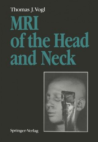 Knjiga MRI of the Head and Neck Vogl