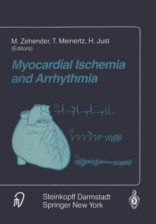 Buch Myocardial Ischemia and Arrhythmia M. Zehender