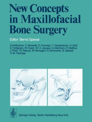 Carte New Concepts in Maxillofacial Bone Surgery B. Spiessl