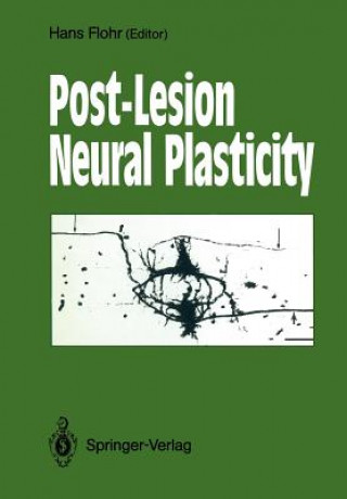 Knjiga Post-Lesion Neural Plasticity Hans Flohr