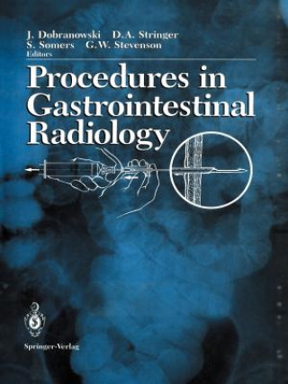 Book Procedures in Gastrointestinal Radiology Giles W. Stevenson