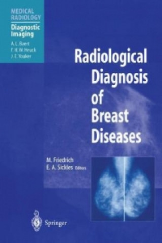 Book Radiological Diagnosis of Breast Diseases Michael Friedrich