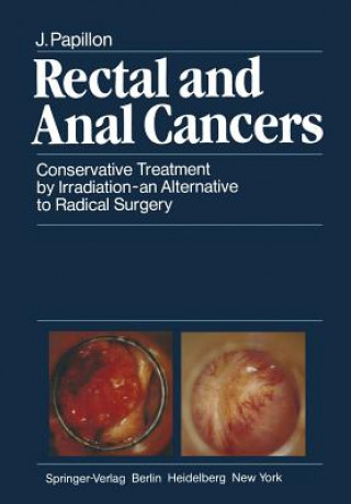 Libro Rectal and Anal Cancers J. Papillon