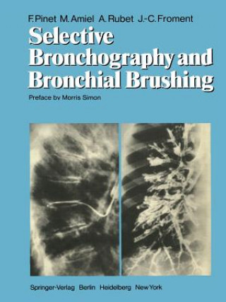 Kniha Selective Bronchography and Bronchial Brushing J.-C. Froment