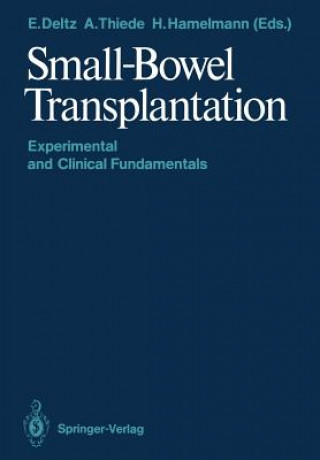 Book Small-Bowel Transplantation Eberhard Deltz