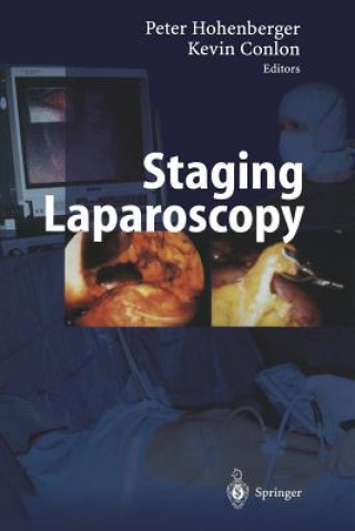 Knjiga Staging Laparoscopy K. Conlon