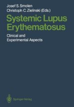 Systemic Lupus Erythematosus