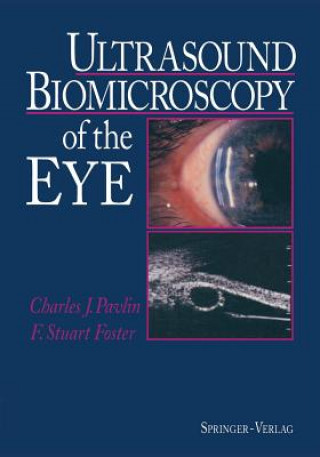Könyv Ultrasound Biomicroscopy of the Eye F.Stuart Foster
