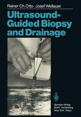 Carte Ultrasound-Guided Biopsy and Drainage Josef Wellauer