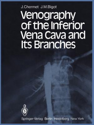 Carte Venography of the Inferior Vena Cava and Its Branches J. M. Bigot