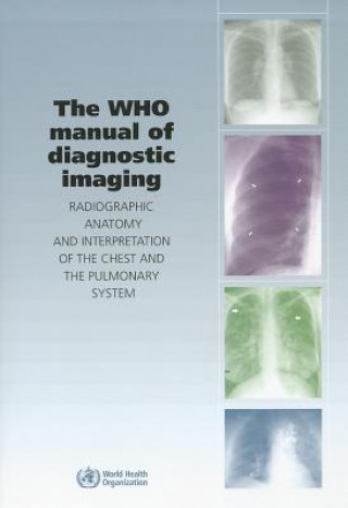 Kniha WHO Manual of Diagnostic Imaging Christopher Flower