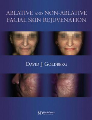 Carte Ablative and Non-ablative Facial Skin Rejuvenation David J. Goldberg
