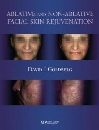 Knjiga Ablative and Non-ablative Facial Skin Rejuvenation David J. Goldberg