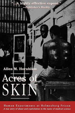 Книга Acres of Skin Allen M. Hornblum
