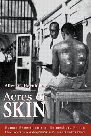 Książka Acres of Skin Allen M. Hornblum