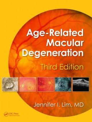 Carte Age-Related Macular Degeneration 