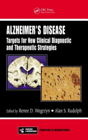 Carte Alzheimer's Disease Renee D. Wegrzyn