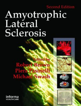 Carte Amyotrophic Lateral Sclerosis, Second Edition 