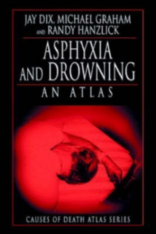 Kniha Asphyxia and Drowning M.D. Randy Hanzlick