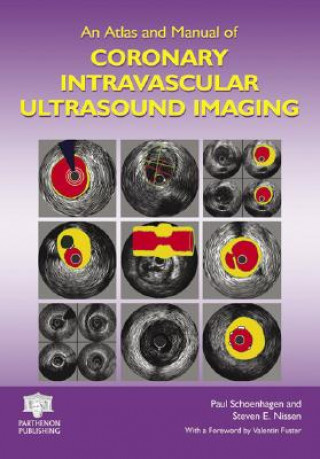 Kniha Atlas and Manual of Coronary Intravascular Ultrasound Imaging 