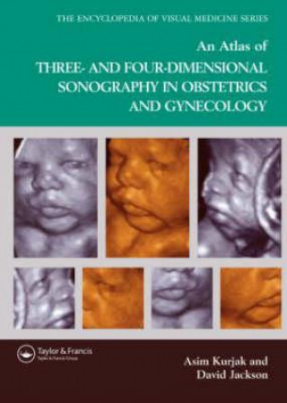 Βιβλίο Atlas of Three- and Four-Dimensional Sonography in Obstetrics and Gynecology Asim Kurjak