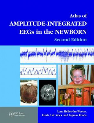 Buch Atlas of Amplitude-Integrated EEGs in the Newborn 