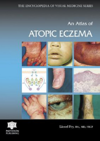 Könyv Atlas of Atopic Eczema Lionel Fry