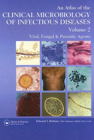 Carte Atlas of the Clinical Microbiology of Infectious Diseases Edward J. Bottone