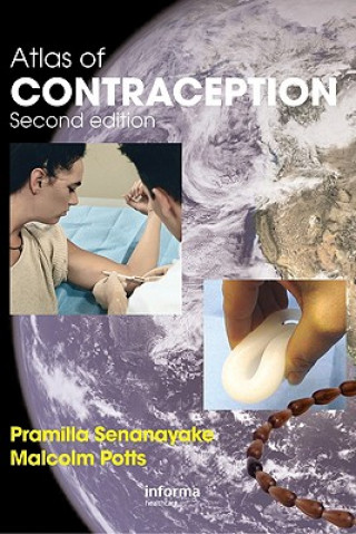 Kniha Atlas of Contraception Malcolm Potts