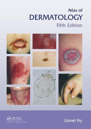 Kniha Atlas of Dermatology, Fifth Edition Lionel Fry
