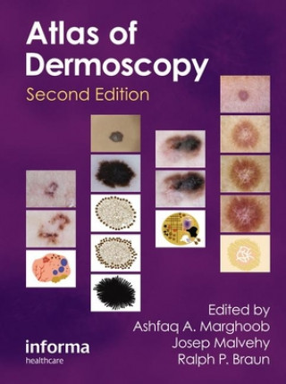 Carte Atlas of Dermoscopy 