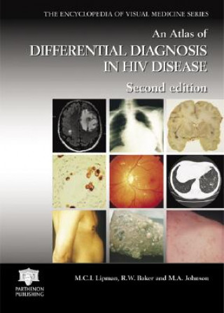 Könyv Atlas of Differential Diagnosis in HIV Disease Johnson