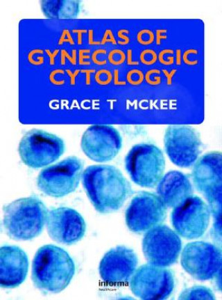 Kniha Atlas of Gynecologic Cytology Grace T. McKee