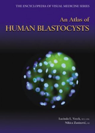 Kniha Atlas of Human Blastocysts Nikica Zaninovic
