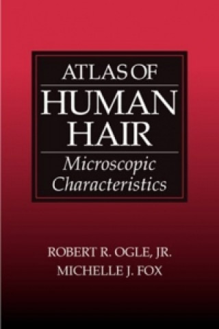 Kniha Atlas of Human Hair Michelle J. Fox