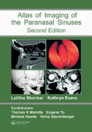Книга Atlas of Imaging of the Paranasal Sinuses, Second Edition 