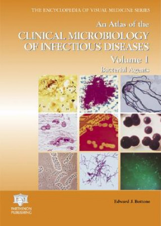 Kniha Atlas of the Clinical Microbiology of Infectious Diseases, Volume 1 Edward J. Bottone