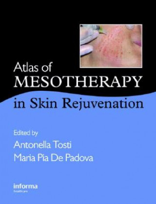 Knjiga Atlas of Mesotherapy in Skin Rejuvenation 