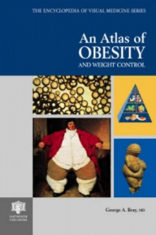 Carte Atlas of Obesity and Weight Control George A. Bray