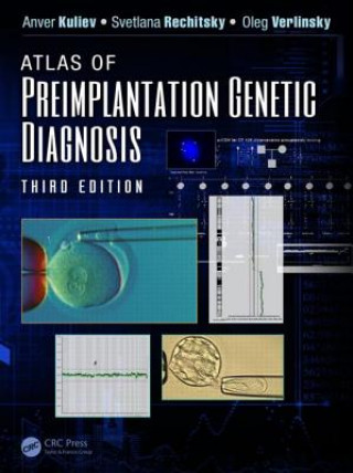 Könyv Atlas of Preimplantation Genetic Diagnosis Oleg Verlinsky