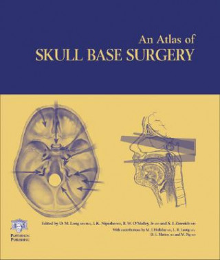 Βιβλίο Atlas of Skull Base Surgery 