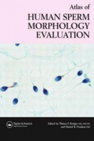 Carte Atlas of Human Sperm Morphology Evaluation 