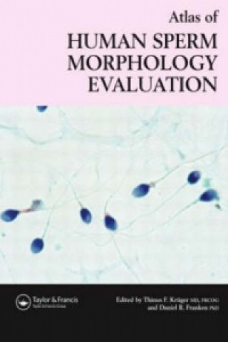 Kniha Atlas of Human Sperm Morphology Evaluation 