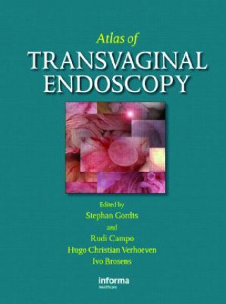 Carte Atlas of Transvaginal Endoscopy 