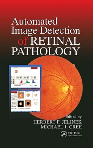 Książka Automated Image Detection of Retinal Pathology Michael J. Cree